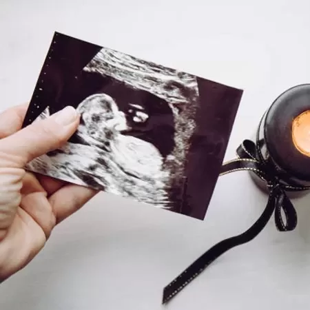 Luto Perinatal 
